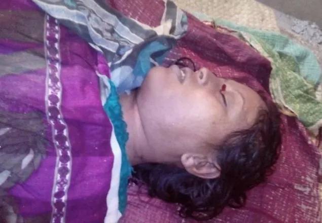 ঝিনাইদহের আসমা খাতুন যৌতুকের বলি !