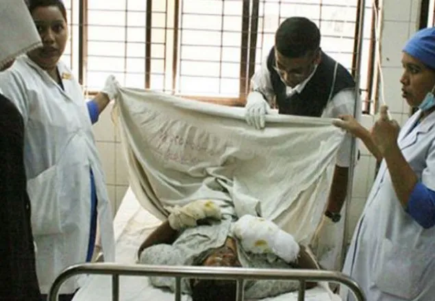 গুলশানে দগ্ধ গৃহকর্মীদের ১ জনের মৃত্যু