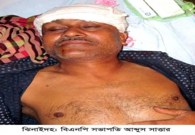 ঝিনাইদহে বিএনপি নেতাকে কুপিয়ে জখম