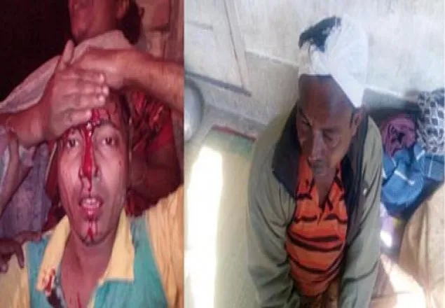 ঝিনাইদহের হরিণাকুন্ডুতে প্রতিপক্ষের হামলায় আহত ৩
