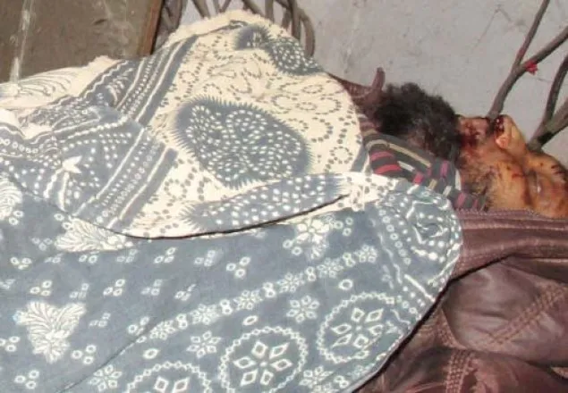 শৈলকুপায় সড়ক দূর্ঘটনায় মোটরসাইকেল আরোহী নিহত 