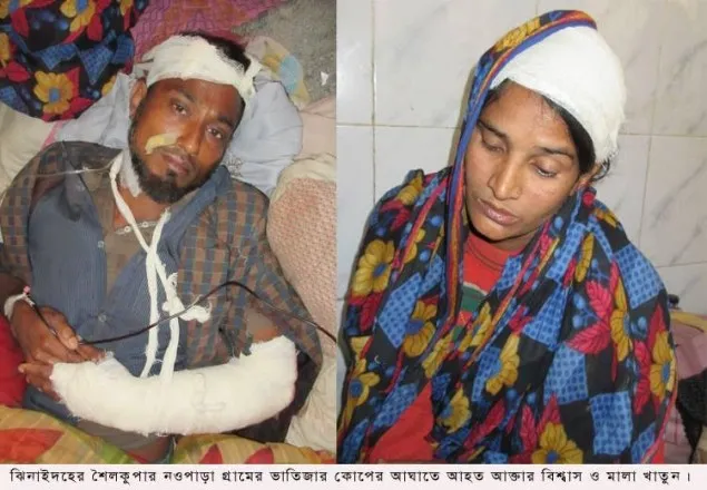 শৈলকুপায় ভাতিজা কতৃক চাচা-চাচীকে কুপিয়ে জখম