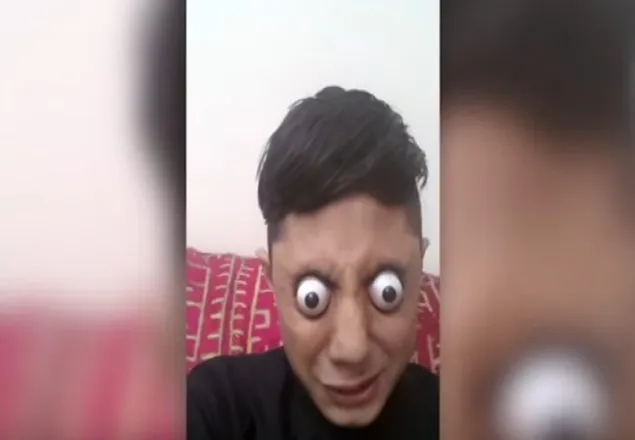 পুরো চোখ সামনে নিয়ে আসা পাকিস্তানী বালক এখন ভাইরাল(ভিডিও)