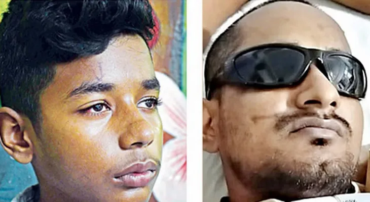 আন্দোলনে গুলিতে ৪০১ জনের চোখ নষ্ট
