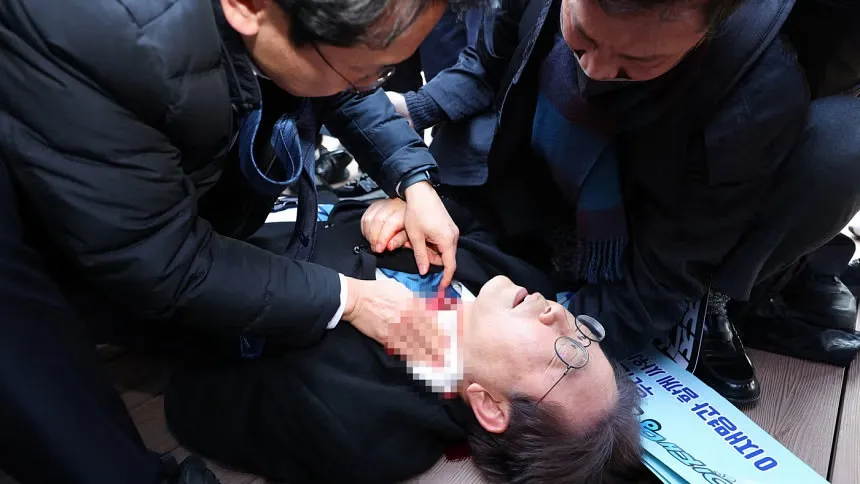 South Korean opposition leader stabbed in neck
