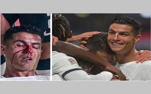 রোনালদোর ‘নাক ফাটার’ রাতে পর্তুগালের জয়