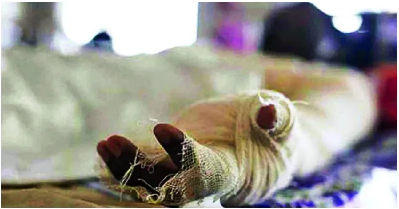 আশুগঞ্জে আগুনে পুড়ে শিশুর মৃত্যু, দগ্ধ তিন