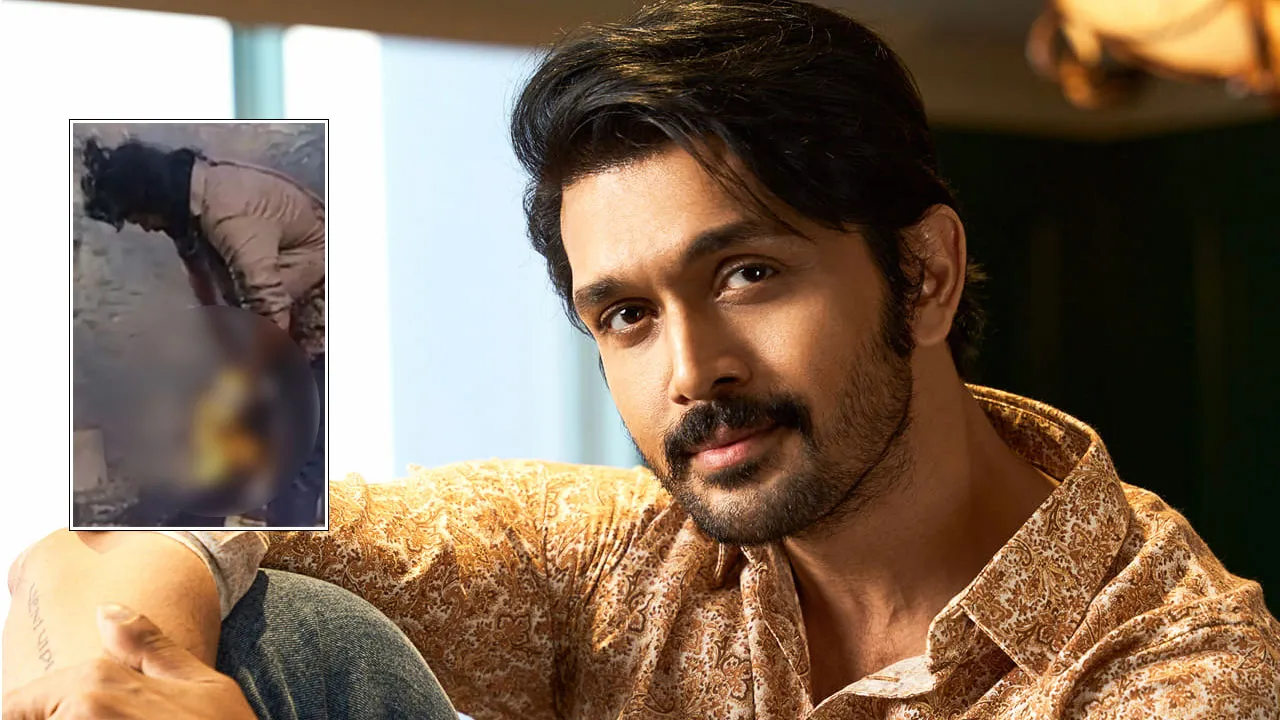 Arifin Shuvo burns on shooting set