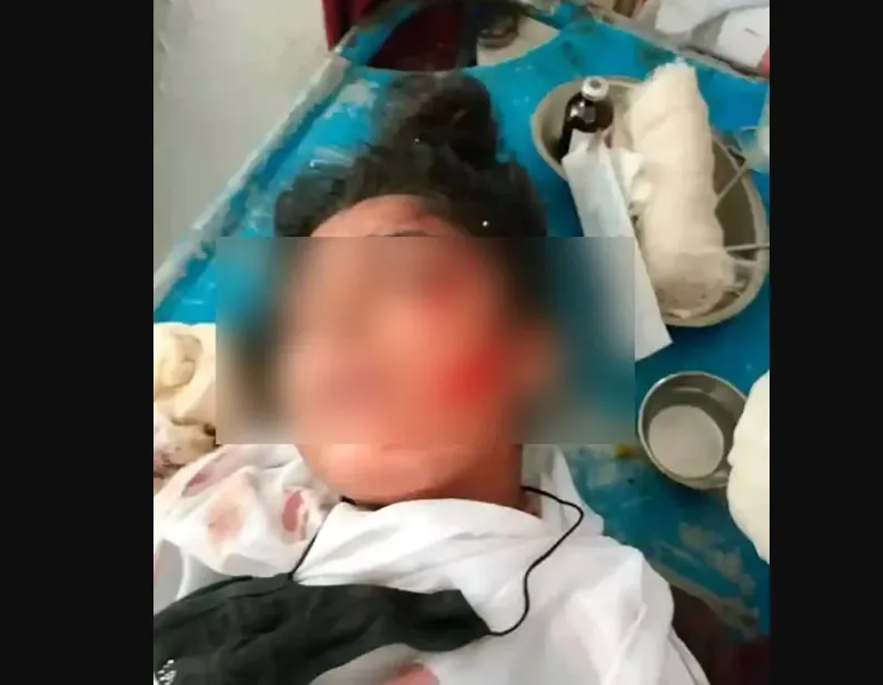 বখাটের ক্ষুরের আঘাতে কলেজছাত্রী গুরুতর আহত