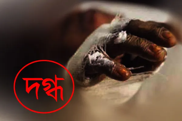 নারায়ণগঞ্জে গ্যাস সিলিন্ডার বিস্ফোরণে দগ্ধ ৪