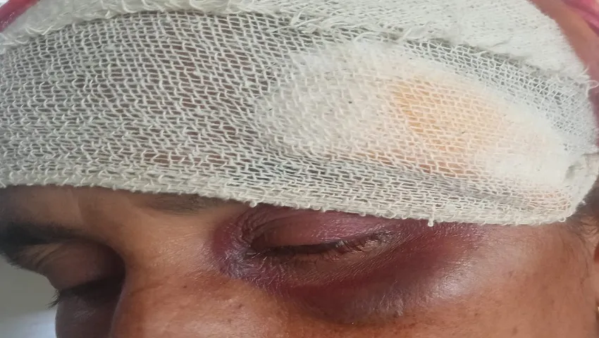 গফরগাঁওয়ে পাগলা থানায় জমিজমা সংক্রান্ত বিরোধে হামলা ও জখম
