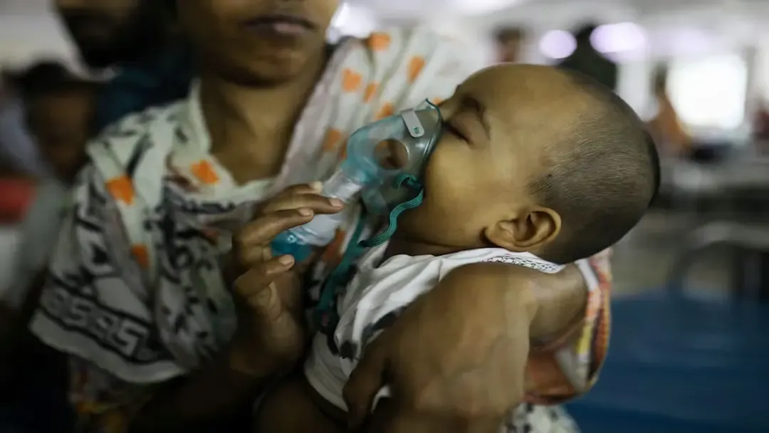 বিশ্বের সবচেয়ে ভয়াবহ হামের প্রাদুর্ভাবের মুখে বাংলাদেশ