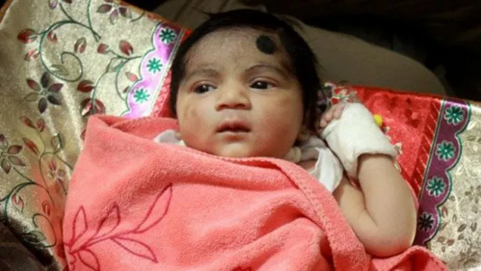 সেই শিশুকে আপাতত ৫ লাখ টাকা দেওয়ার নির্দেশ