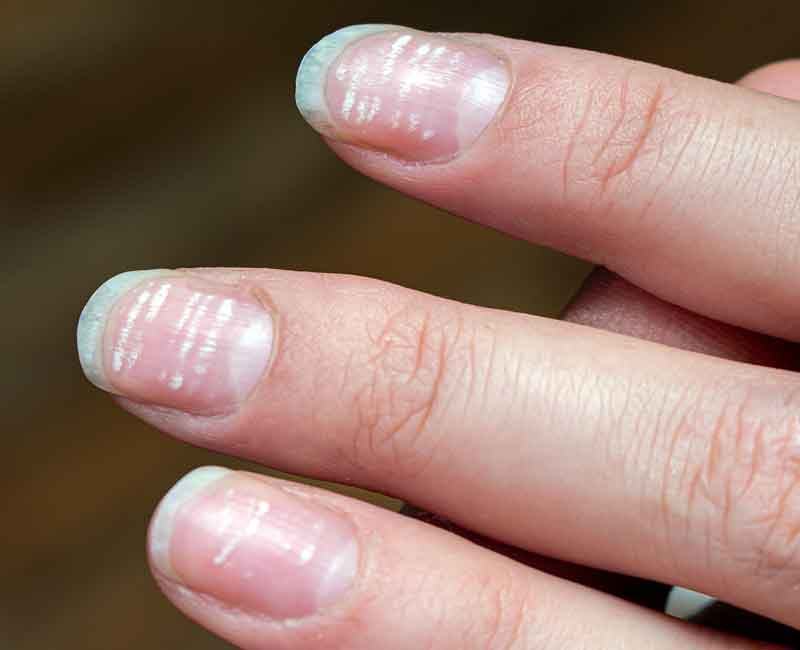 nails_20260421_182810237