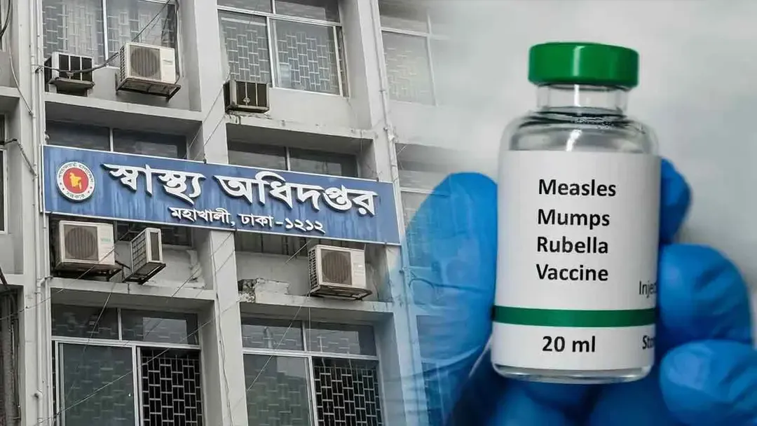 হাম ও উপসর্গে মৃতের সংখ্যা ছাড়াল ৯০০