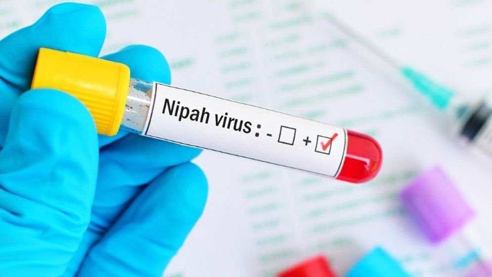 nipah-virus-test-jug-695e215c556b6