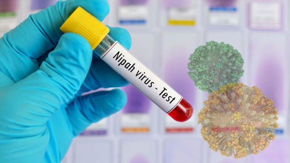 nipah-virus