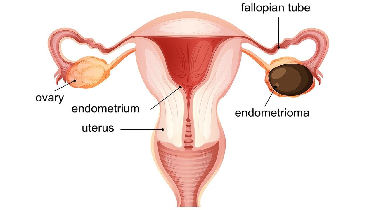 ovary-1-20260408103226