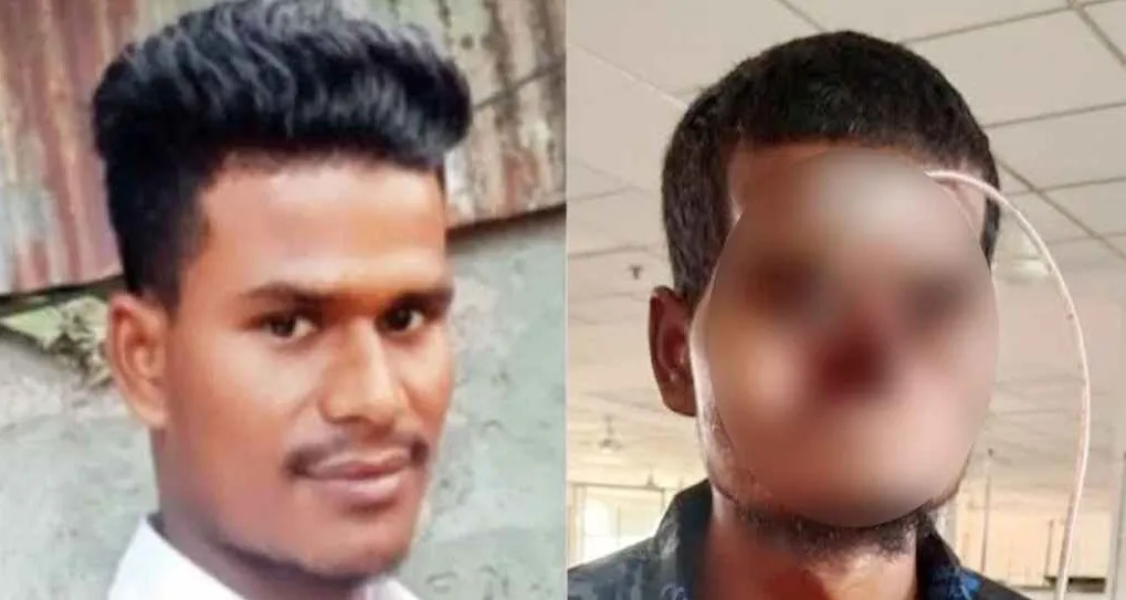 গণঅভ্যুত্থানে গুরুতর আহত খোকনকে চিকিৎসার জন্য রাশিয়ায় পাঠানো হচ্ছে