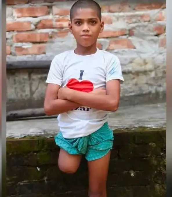 ৭ মাস পর পা ও কিডনি হারিয়ে ফিরল নিখোঁজ সন্তান