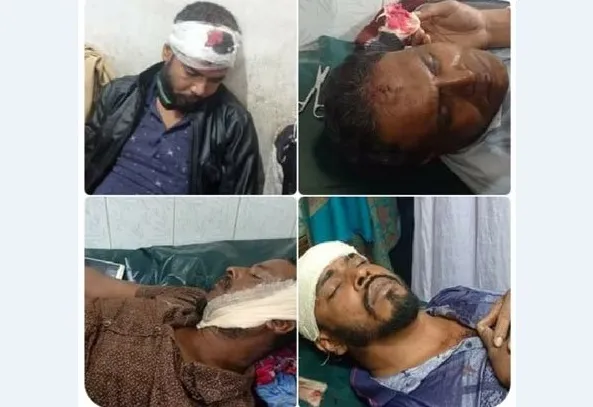 রায়পুরে দুই প্রার্থীর সমর্থকদের সংঘর্ষে আহত ১০