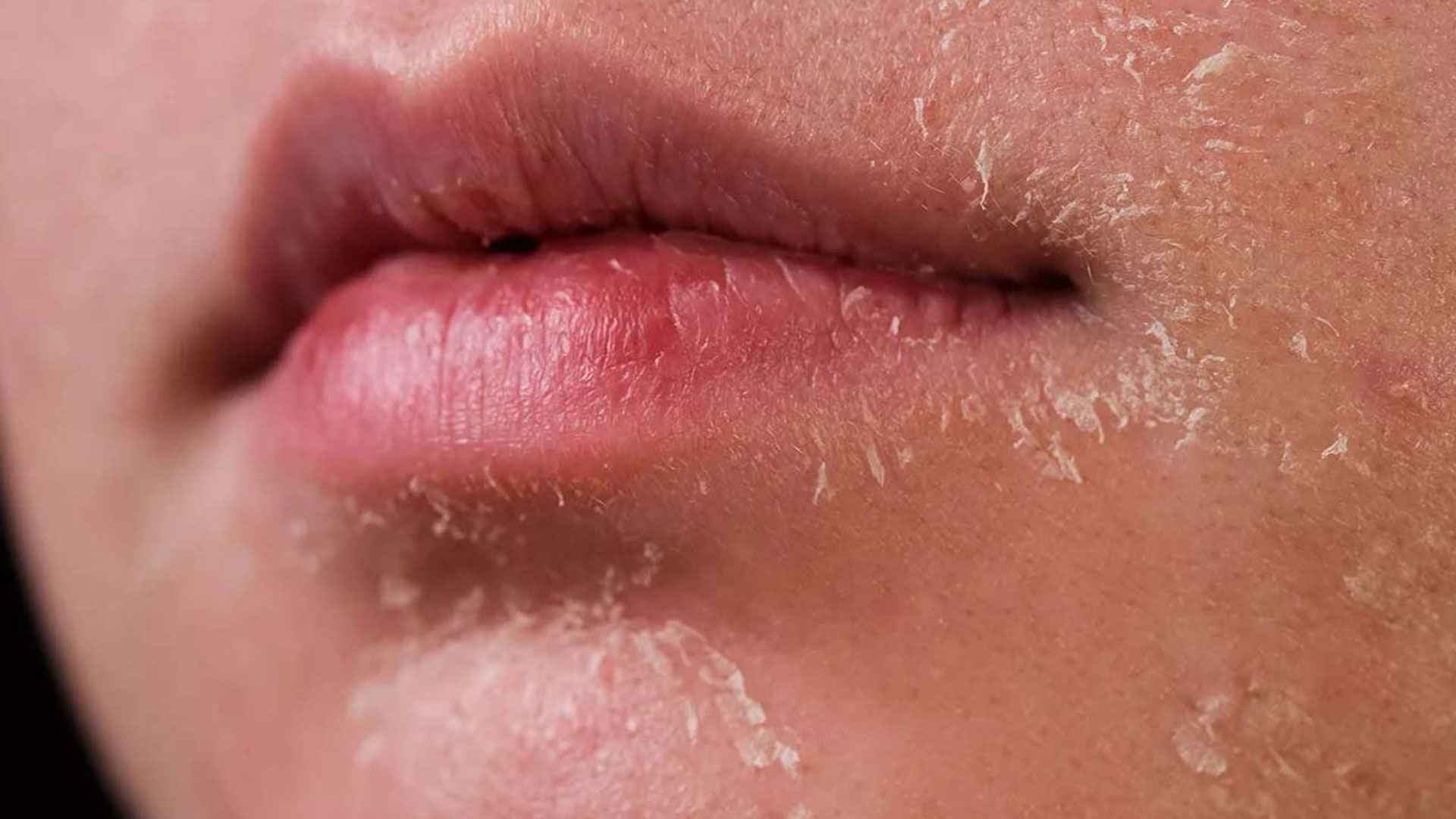 skin_20260421_182604468