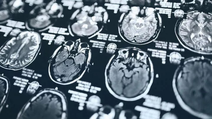stop-d-brain-scan-image-thumbnail-size.x2d720330-64c63544c01252693481235aa7a271fc