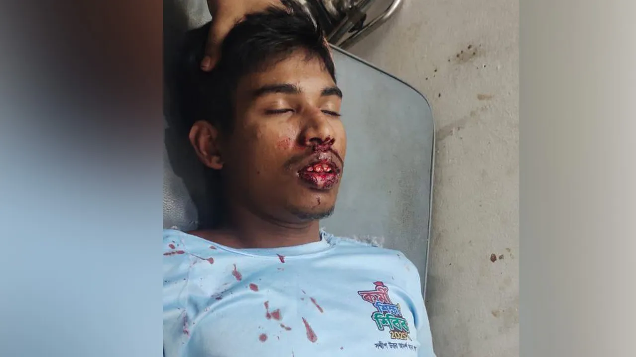 নামাজরত শিক্ষার্থীর ওপর সশস্ত্র হামলা, শিবিরের প্রতিবাদ