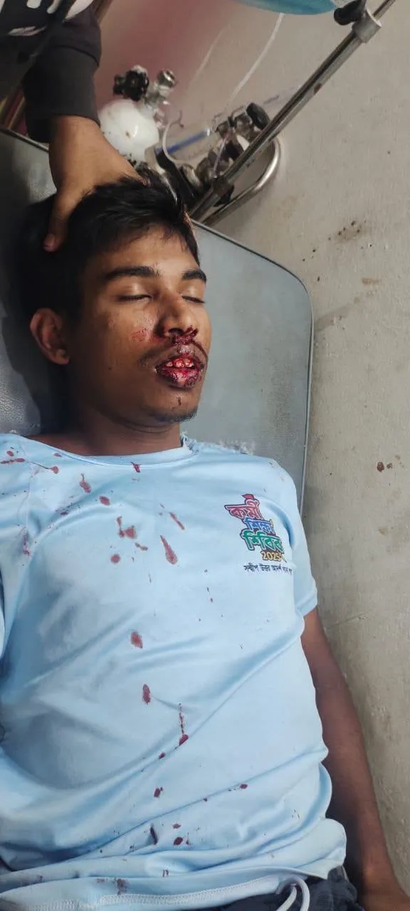 নামাজরত শিক্ষার্থীর ওপর সশস্ত্র হামলা, শিবিরের প্রতিবাদ