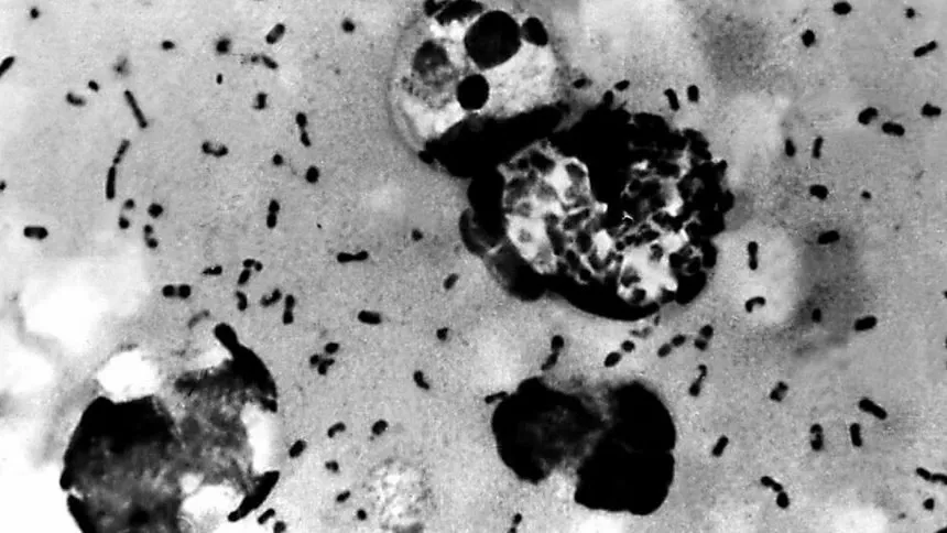 US officials confirm rare human case of bubonic plague