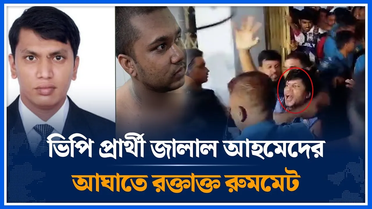 ভিপি প্রার্থী জালাল আহমেদের আ/ঘাতে র/ক্তাক্ত রুমমেট সিরাজুল ইসলাম | DUCSU candidate | Time News