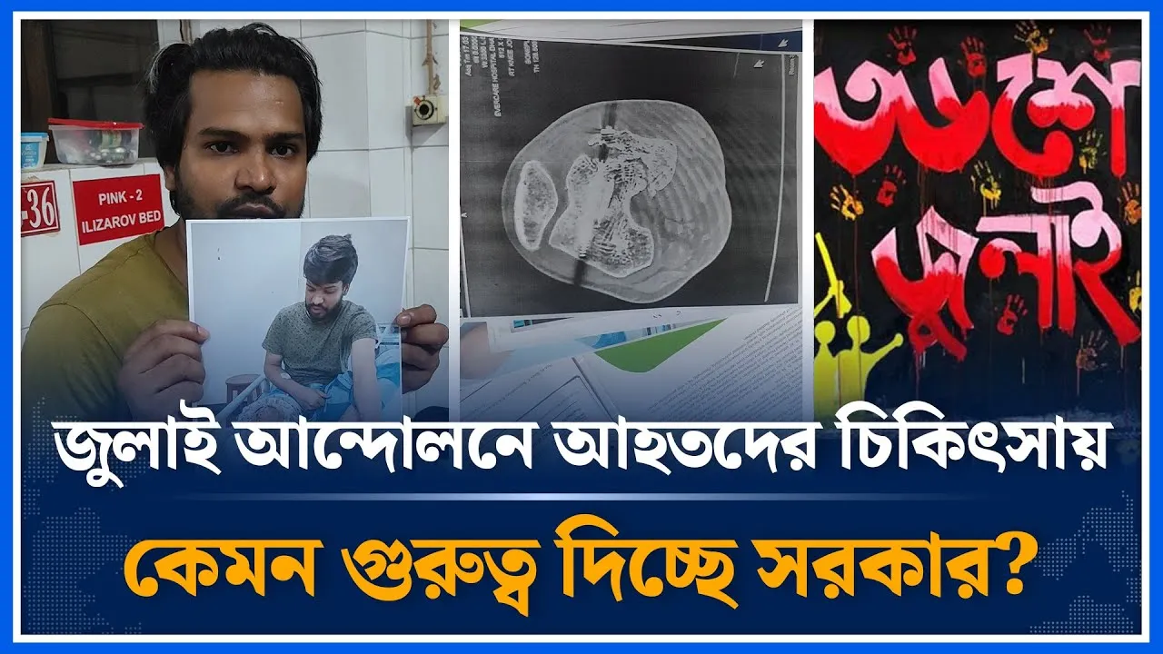 জুলাই আ'ন্দোলনে আহতরা চিকিৎসা সেবায় কেমন গুরুত্ব পাচ্ছে | July | Andolon | Time News