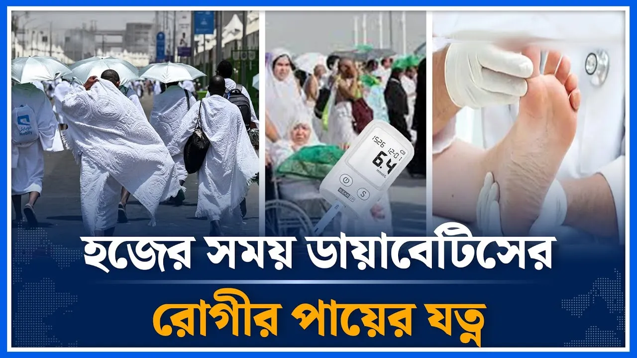হজের সময় ডায়াবেটিসের রোগীর পায়ের যত্ন | Diabetes | Hajj | Time News