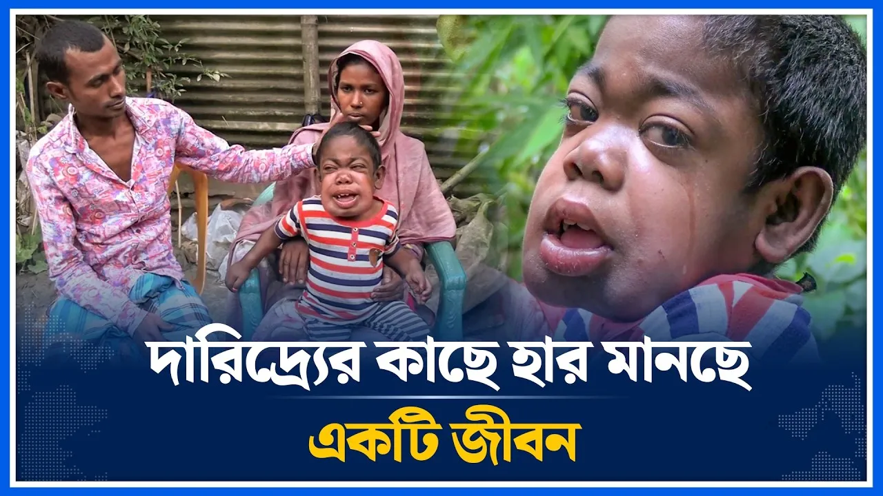 অজানা রোগেের সাথে লড়াই, আব্দুল্লাহর চোখে বাঁচার আকুতি | Sirajganj News | Time News